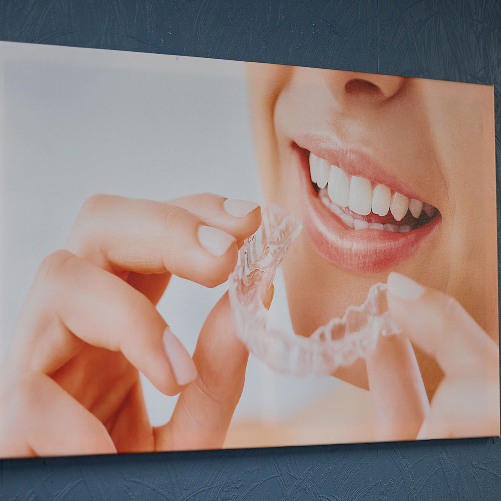 invisalign